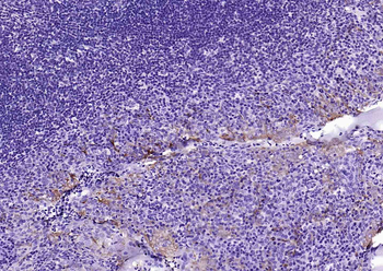 Mesothelin Recombinant Rabbit Monoclonal Antibody