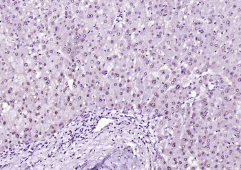 Arginase 1 Recombinant Rabbit Monoclonal Antibody