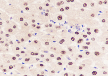 Arginase 1 Recombinant Rabbit Monoclonal Antibody