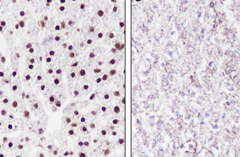 Ubiquityl-Histone H2B (Lys120) Recombinant Rabbit Monoclonal Antibody