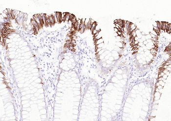 MUC-4 Recombinant Rabbit Monoclonal Antibody