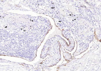 MUC-4 Recombinant Rabbit Monoclonal Antibody