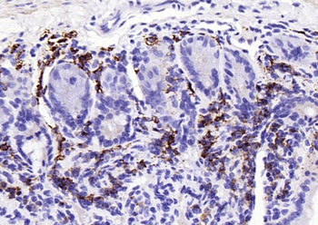 JCHAIN Recombinant Rabbit Monoclonal Antibody