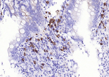 JCHAIN Recombinant Rabbit Monoclonal Antibody
