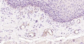 CD62p Recombinant Rabbit Monoclonal Antibody