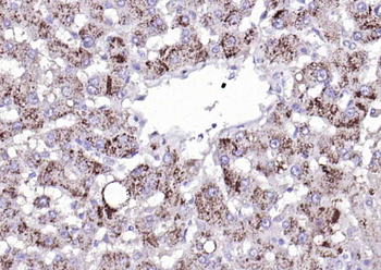 Catalase Recombinant Mouse Monoclonal Antibody