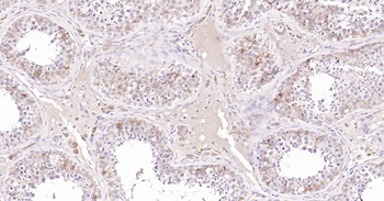 Inhibin alpha Recombinant Rabbit Monoclonal Antibody