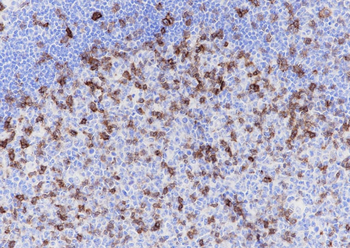 ICOS Recombinant Rabbit Monoclonal Antibody
