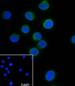 CD11a Recombinant Mouse Monoclonal Antibody