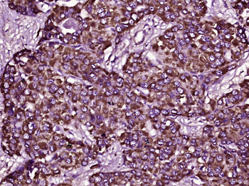 PRSS1 Rabbit Polyclonal Antibody