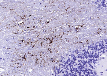 GFAP Recombinant Rabbit Monoclonal Antibody