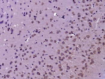 Tyrosine Hydroxylase Rabbit Polyclonal Antibody