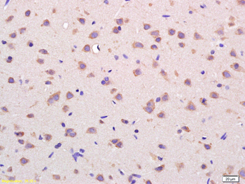 VDAC Rabbit Polyclonal Antibody