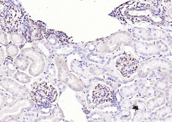 Vimentin Rabbit Polyclonal Antibody