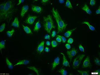 Vimentin Rabbit Polyclonal Antibody