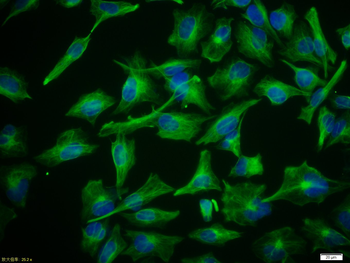 Vimentin Rabbit Polyclonal Antibody