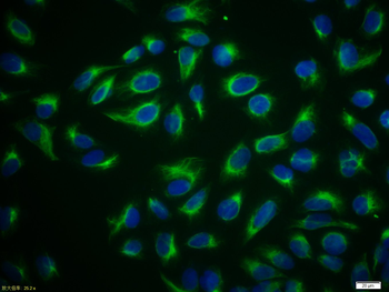 Vimentin Rabbit Polyclonal Antibody