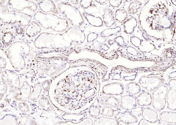 Vimentin Rabbit Polyclonal Antibody