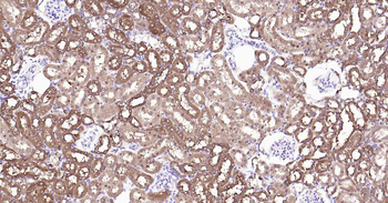 ALDH1L1 Recombinant Rabbit Monoclonal Antibody