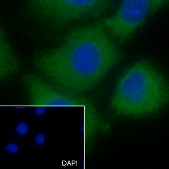 LHB Recombinant Rabbit Monoclonal Antibody