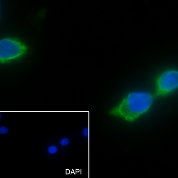 TSHB Recombinant Rabbit Monoclonal Antibody