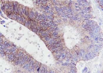 CLDN1 Recombinant Rabbit Monoclonal Antibody