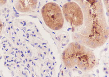 IDH1 Recombinant Mouse Monoclonal Antibody