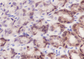 IDH1 Recombinant Mouse Monoclonal Antibody