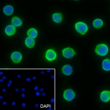 ALDOA Recombinant Rabbit Monoclonal Antibody
