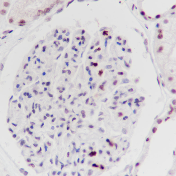 Phospho-Histone H3 (Ser10) Recombinant Mouse Monoclonal Antibody