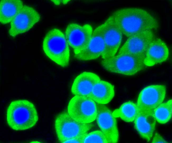 ACLY Recombinant Rabbit Monoclonal Antibody