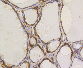 ACLY Recombinant Rabbit Monoclonal Antibody