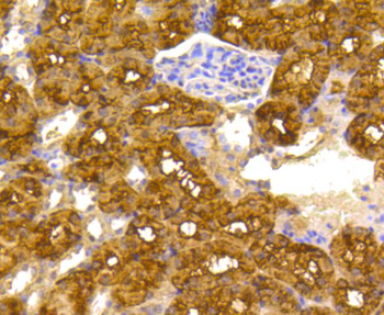 ACLY Recombinant Rabbit Monoclonal Antibody