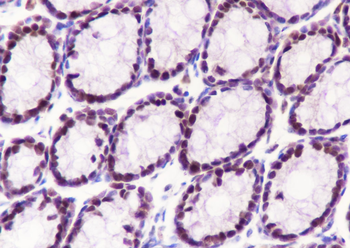 MCM3 Recombinant Rabbit Monoclonal Antibody