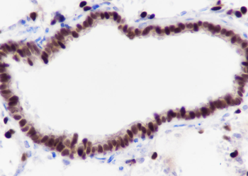 TTF1/NKX2-1 Recombinant Rabbit Monoclonal Antibody