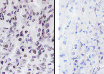 Histone H3 (Tri Methyl K36) Recombinant Rabbit Monoclonal Antibody