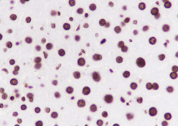 Mono-Methyl-Histone H3 (Lys36) Recombinant Rabbit Monoclonal Antibody