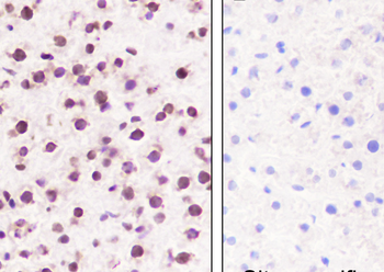 Mono/Di-Methyl-Histone H3 (Lys79) Recombinant Rabbit Monoclonal Antibody