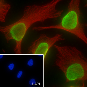 Mono-Methyl-Histone H4 (Lys12) Recombinant Rabbit Monoclonal Antibody