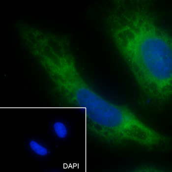 ABCE1 Recombinant Rabbit Monoclonal Antibody
