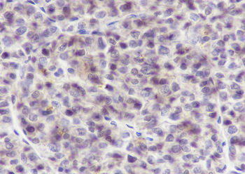 DDB1 Recombinant Mouse Monoclonal Antibody