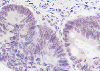 PABPN1 Recombinant Mouse Monoclonal Antibody