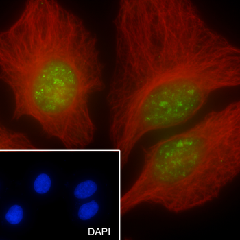 MCM5 Recombinant Rabbit Monoclonal Antibody