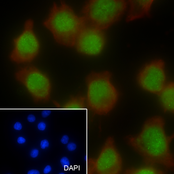 SOX10 Recombinant Rabbit Monoclonal Antibody