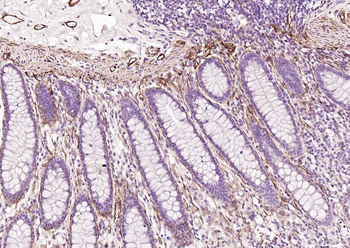 Caldesmon Recombinant Mouse Monoclonal Antibody
