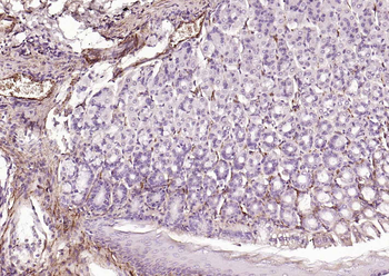 Caldesmon Recombinant Mouse Monoclonal Antibody