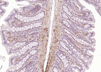 Caldesmon Recombinant Mouse Monoclonal Antibody