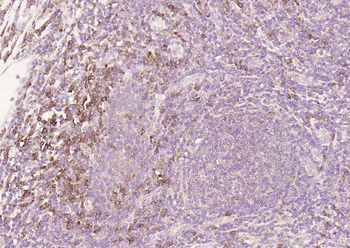 CD25 Recombinant Rabbit Monoclonal Antibody