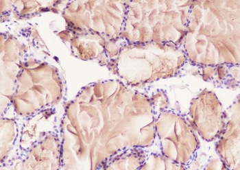TG Recombinant Rabbit Monoclonal Antibody