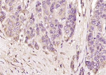 AFP Rabbit Polyclonal Antibody